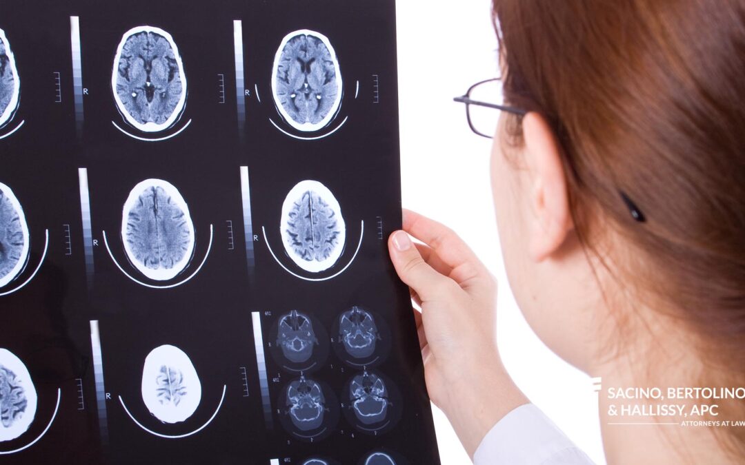 What are the Symptoms of a TBI?