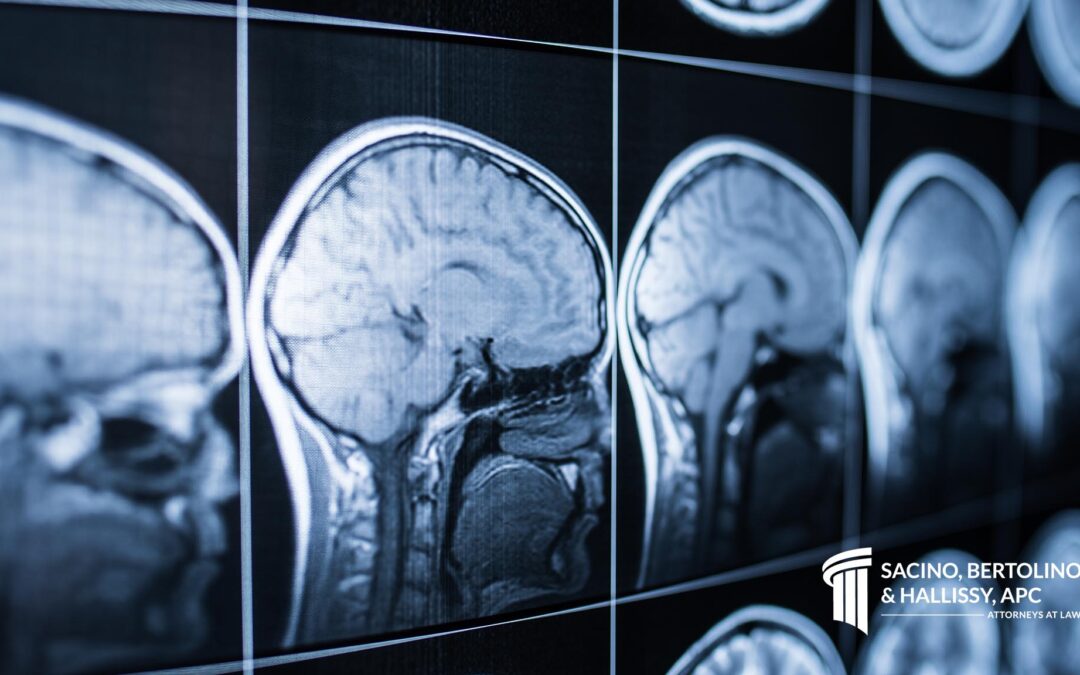 How do Brain Injuries Manifest?
